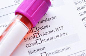 Blutprobe und Laborformular mit Vitamin-B12-Wert als Symbol für Selbsttests für Vitamine und Mineralstoffe.